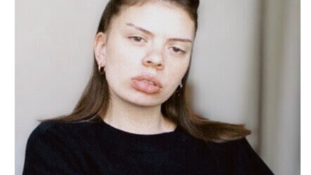 Whitagram-Image 4